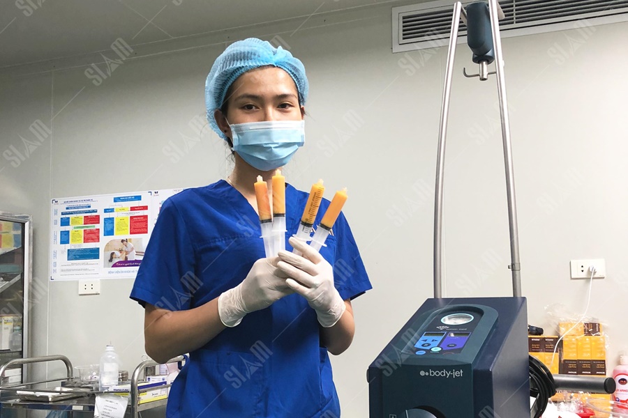 Bơm mông bằng mỡ tự thân